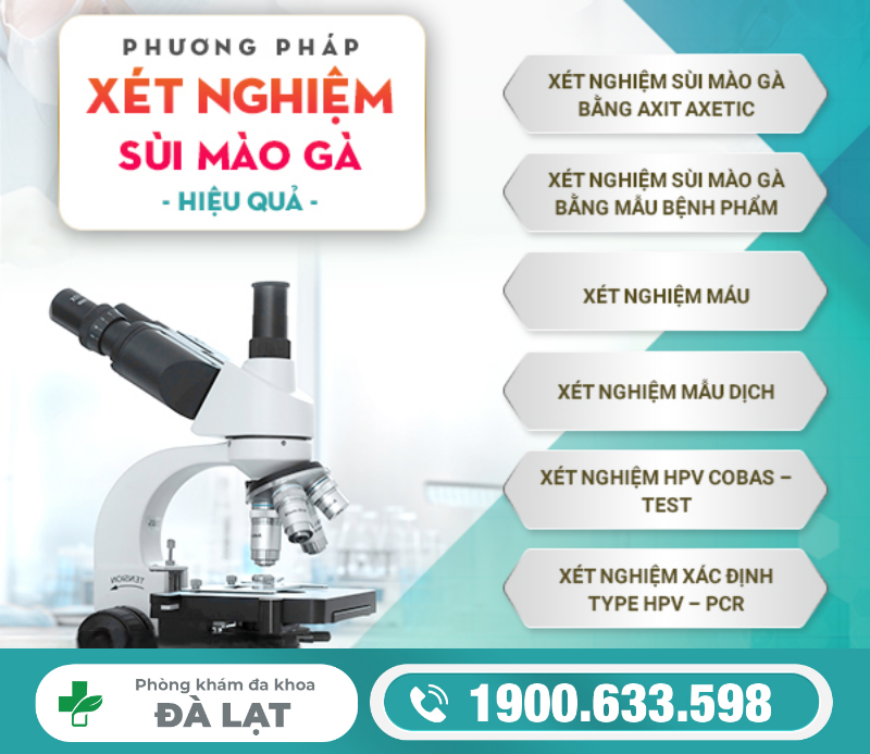 Hình ảnh minh họa